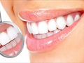 Стоматологи назвали найголовніші міфи про зуби
