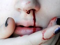 Чому з носа йде кров: поширені причини